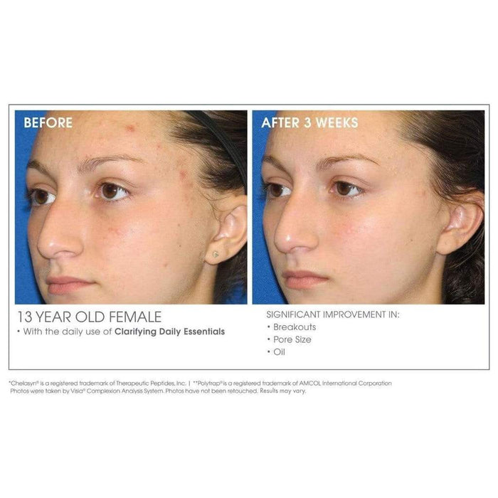 Clarifying + Refining Serum