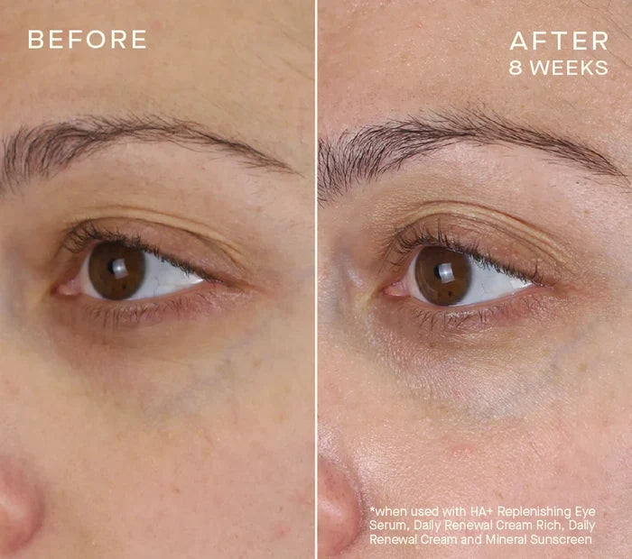 Advanced Regenerative Eye Serum