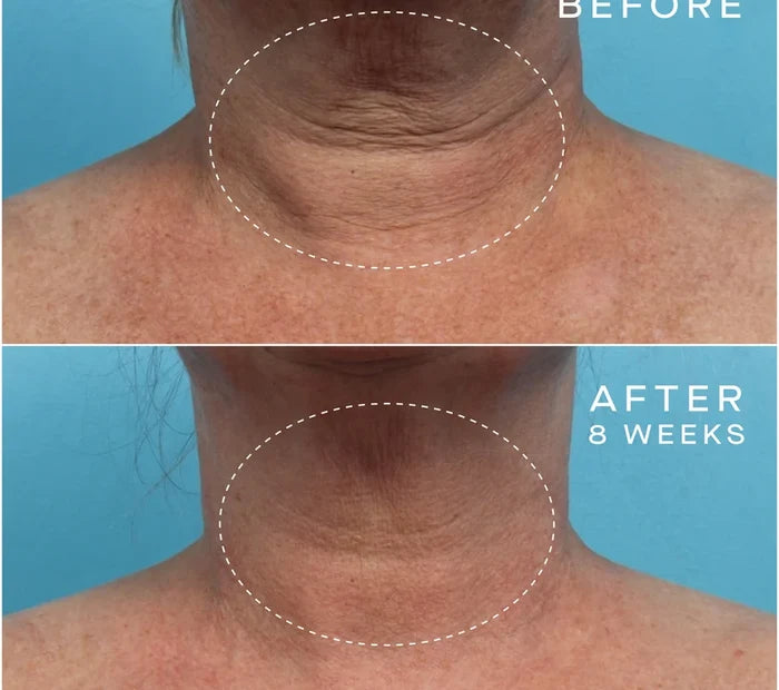 Advanced Regenerative Serum 30mL
