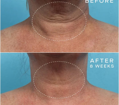 Advanced Regenerative Serum 30mL