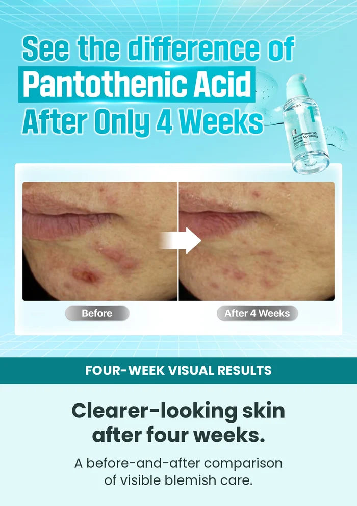 Four-week visual comparison for Numbuzin No.1 soothing serum