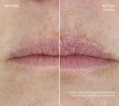 Replenishing Lip Filler